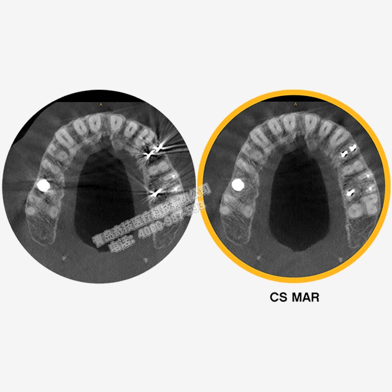 新疆口腔全景機CBCT銳珂Carestream產(chǎn)品介紹維修
