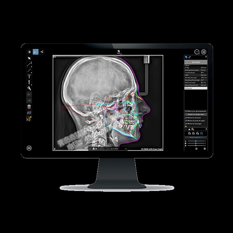 西藏口腔全景機CBCT銳珂Carestream產(chǎn)品介紹維修