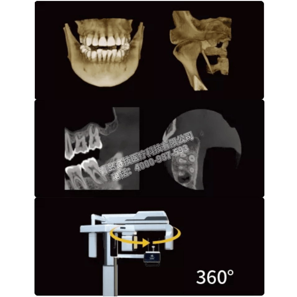 河南口腔CBCT 全景機(jī)LARGEV國(guó)產(chǎn)朗視產(chǎn)品介紹