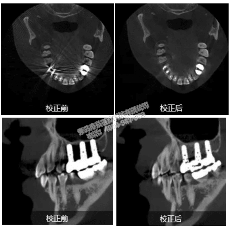 北京口腔CBCT 全景機(jī)LARGEV國產(chǎn)朗視產(chǎn)品介紹