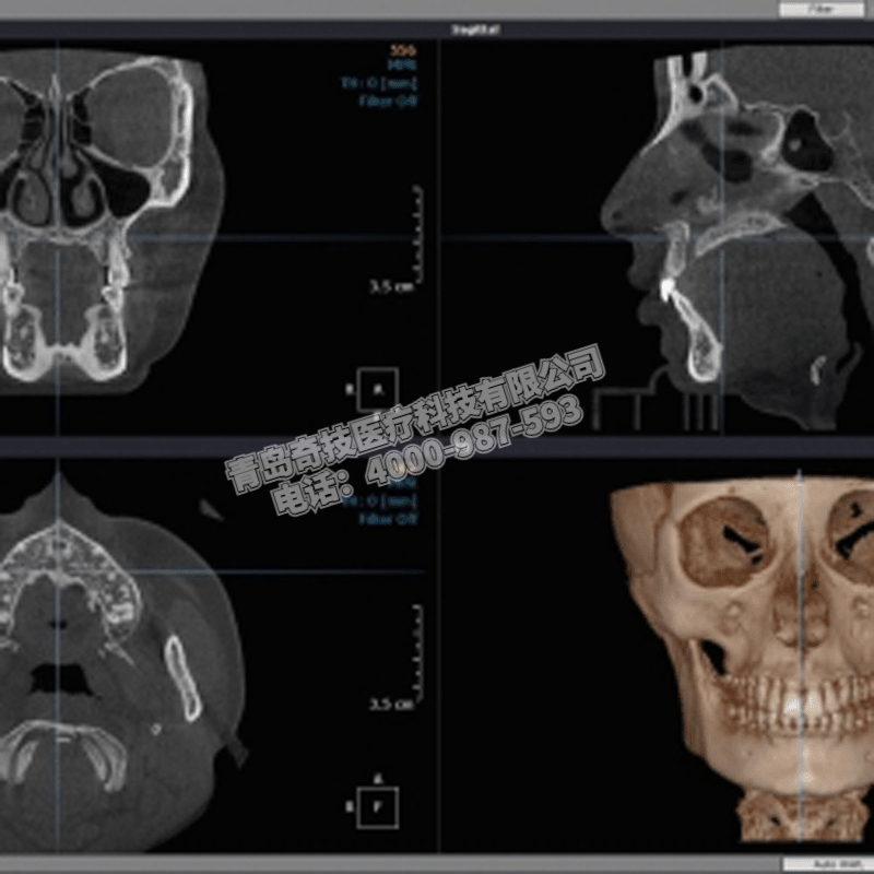 海南坐式大視野HDX WillDENTRI口腔全景機(jī)牙科CBCT維修