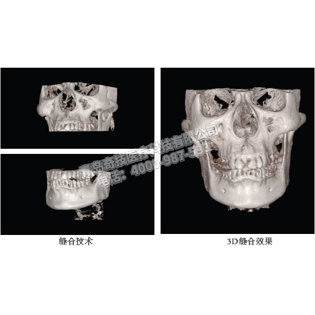 云南口腔CBCT 口腔全景機韓國HDX產(chǎn)品介紹