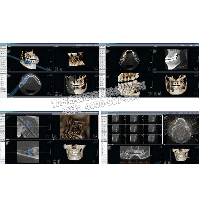 西藏口腔全景機(jī)CBCT牙科CT韓國盤泰產(chǎn)品介紹Point 800 HD