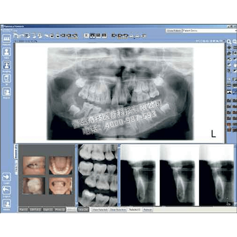 寧夏口腔CBCT 全景機(jī)芬蘭普蘭梅卡產(chǎn)品介紹ProOne