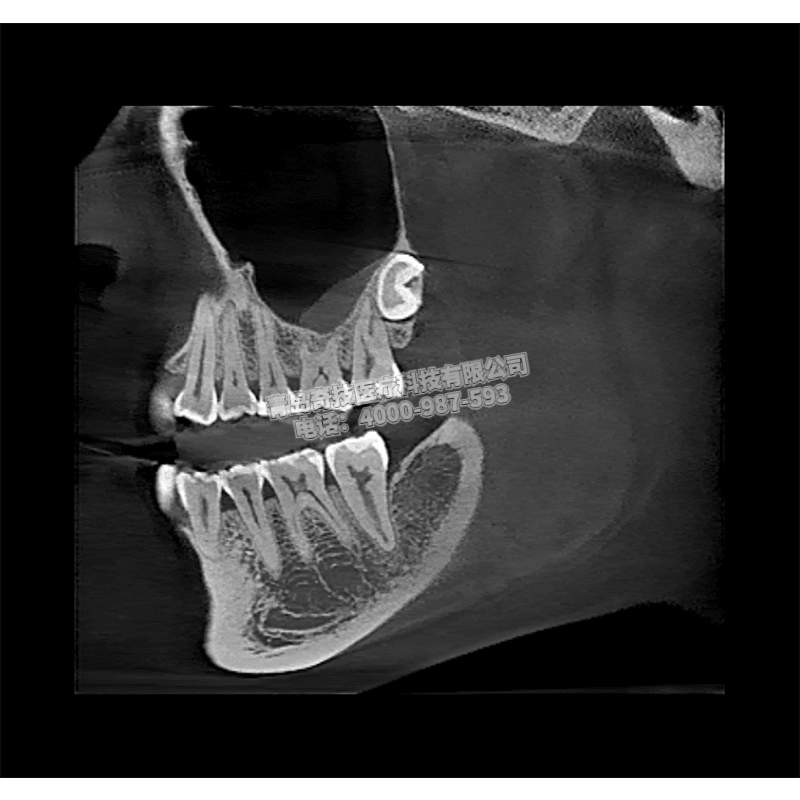 寧夏口腔CBCT 全景機(jī)美亞光電產(chǎn)品介紹