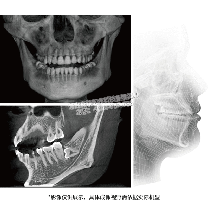 甘肅二手美亞光電口腔全景機(jī)牙科CT維修