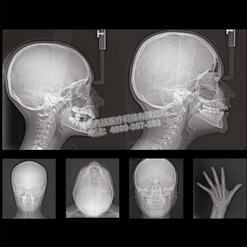 湖北CS9300銳珂口腔全景機(jī)二手牙科CT