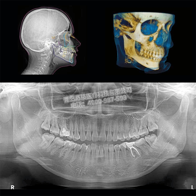 上海口腔全景機(jī)CBCT美國銳珂CS9300產(chǎn)品介紹