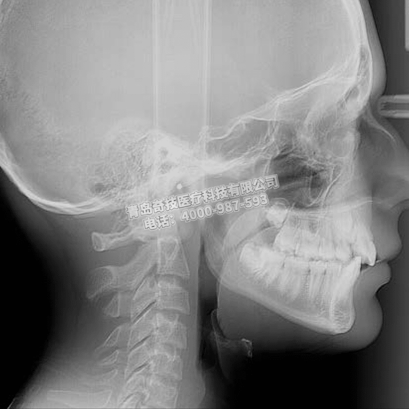 遼寧口腔CBCT 口腔全景機(jī)德國(guó)卡瓦產(chǎn)品介紹雪鷹CRANEX 3Dx