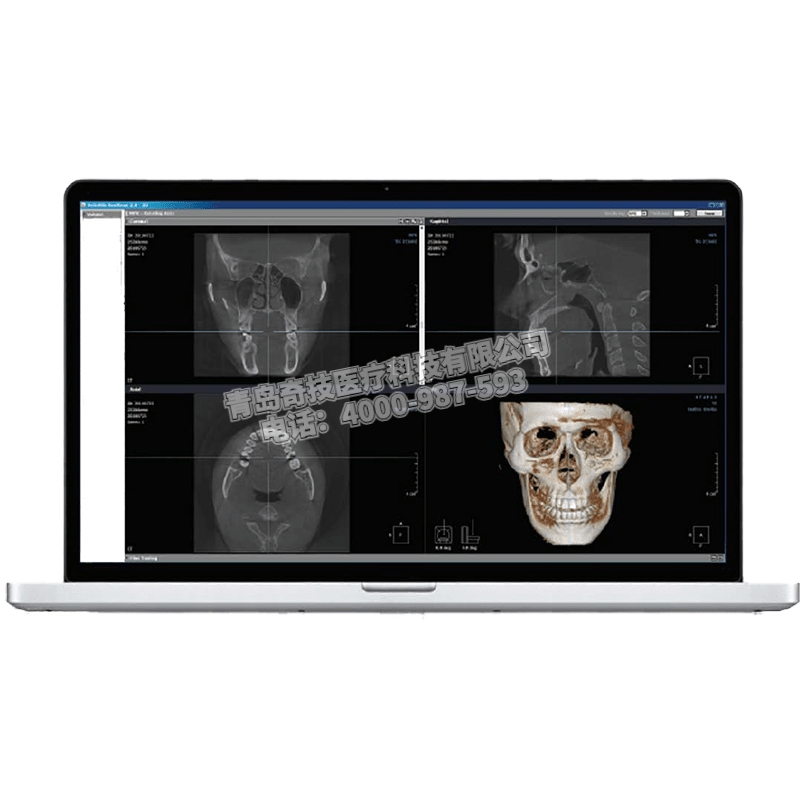 江蘇口腔全景機CBCT韓國盤泰產品介紹
