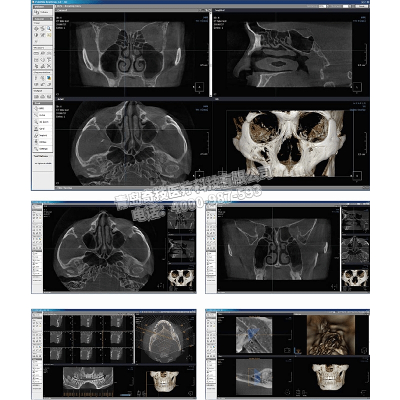 湖南口腔全景機(jī)CBCT韓國盤泰產(chǎn)品介紹