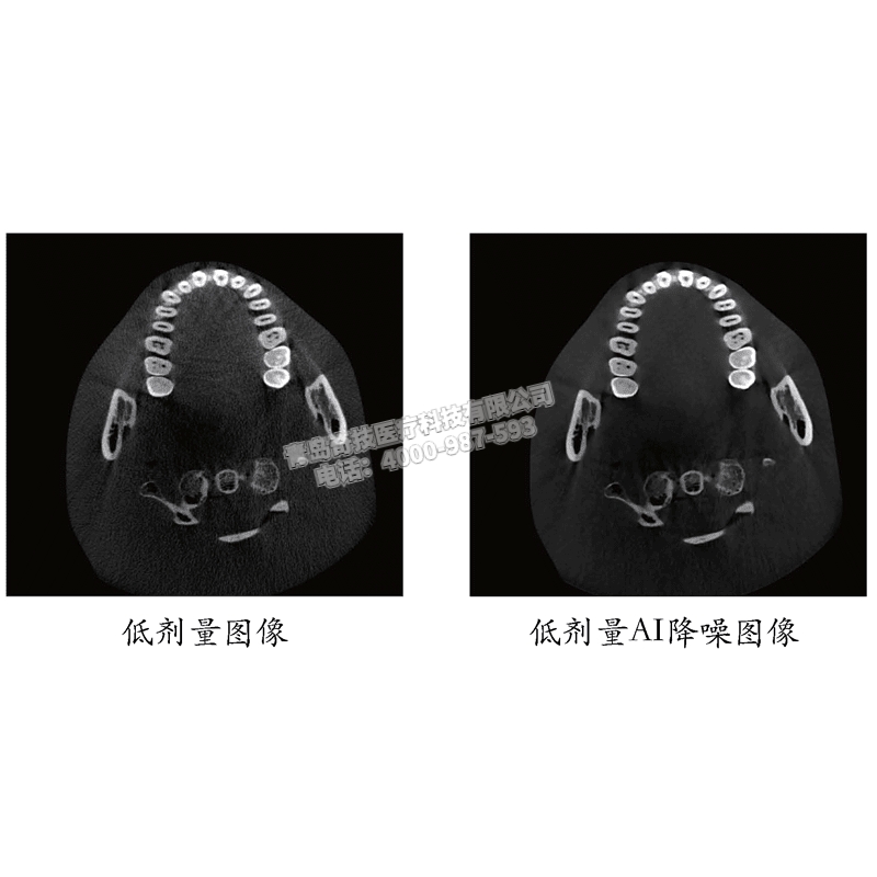 廣東口腔CBCT 口腔全景機(jī)博恩登特產(chǎn)品介紹