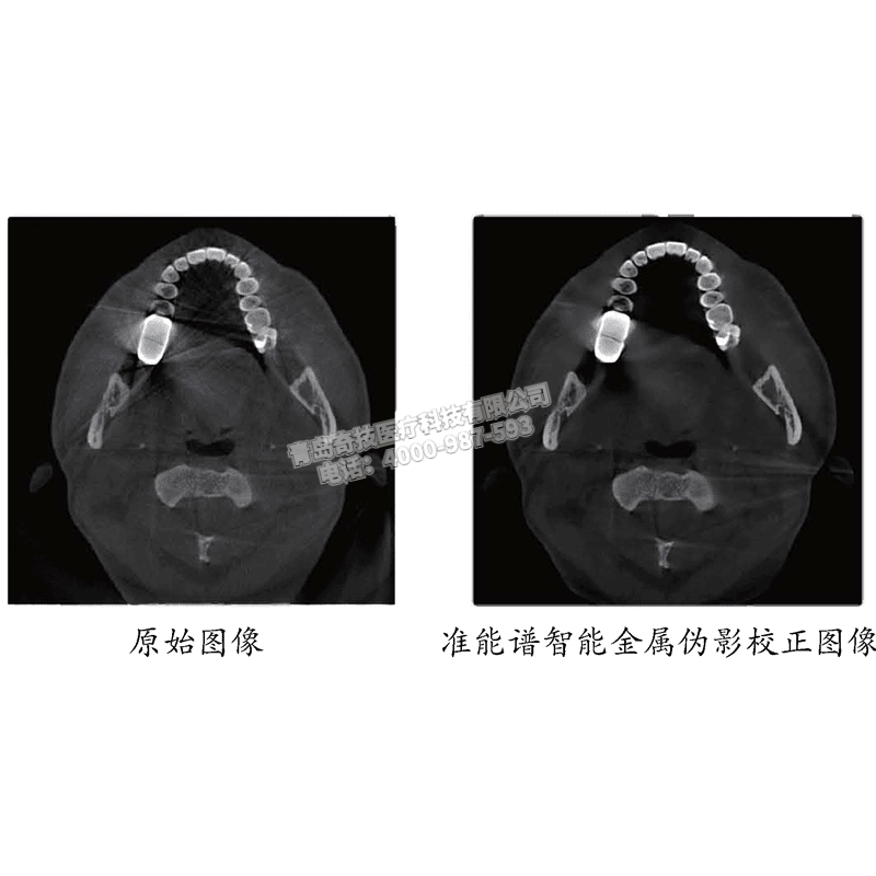 吉林口腔CBCT 口腔全景機(jī)博恩登特產(chǎn)品介紹