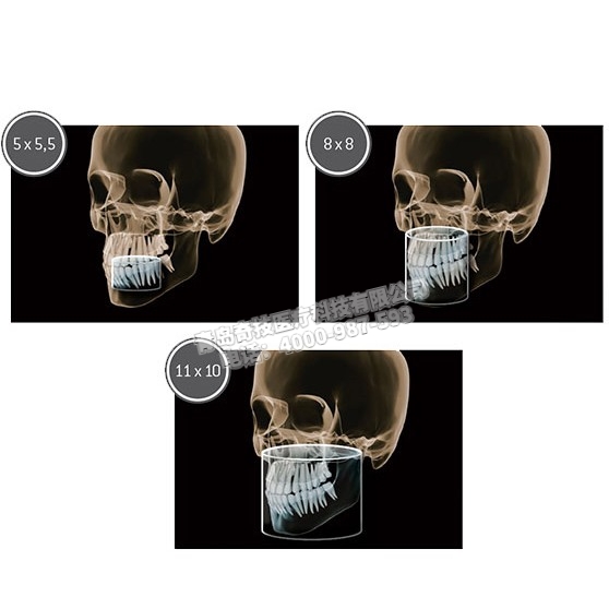 陜西口腔全景機(jī)西諾德二手CBCTXG 3D