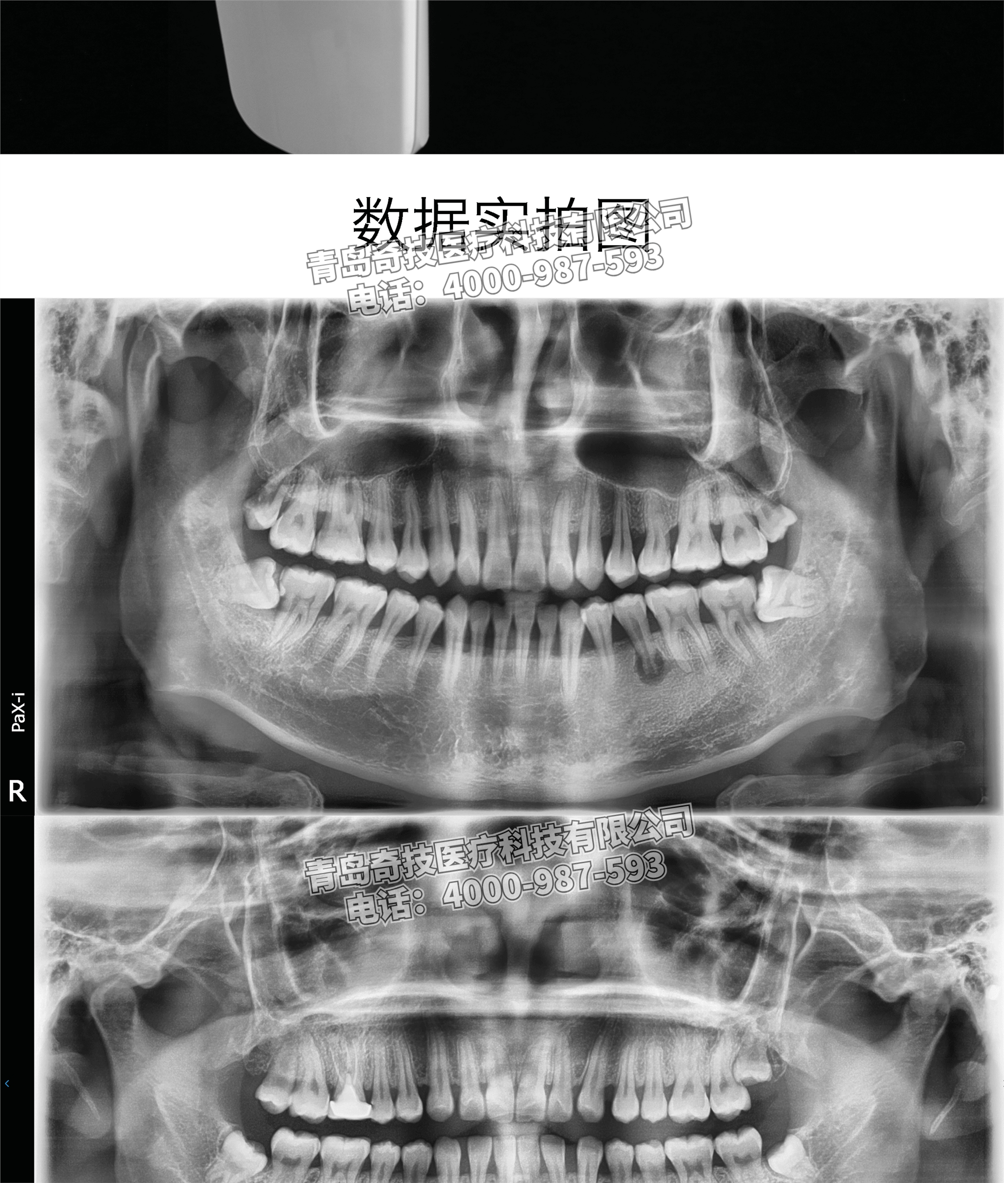 福建轉(zhuǎn)讓韓國(guó)怡友二手口腔全景機(jī)牙科CT