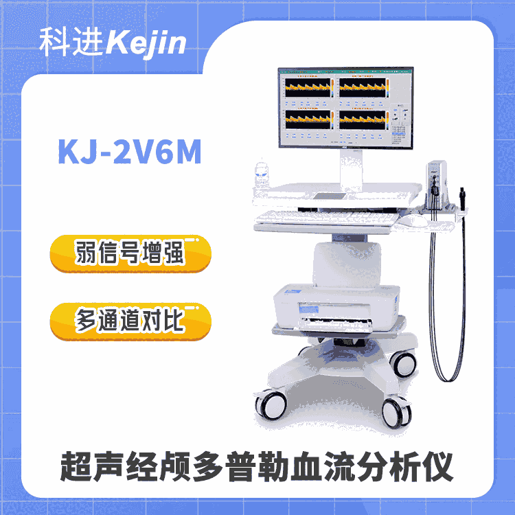 超聲經(jīng)顱多普勒報(bào)告單怎么看